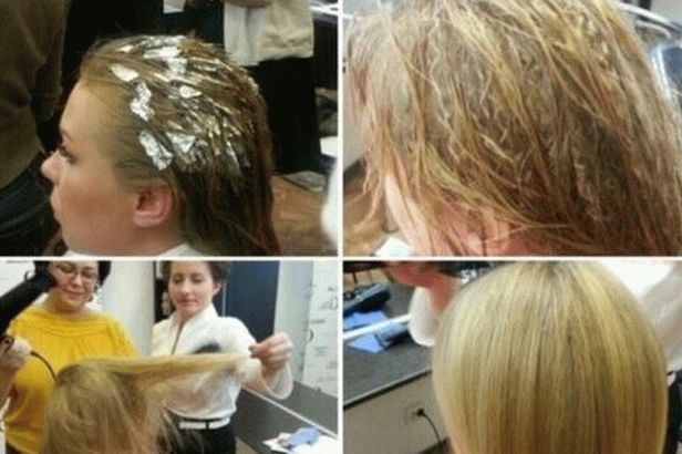 Basal Volume Boost Up