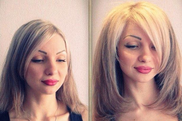 Basal Volume Boost Up